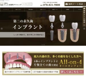 3000症例以上インプラント手術経験ある医師駐在する「医療法人うしじま歯科クリニック」