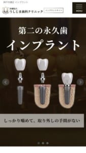 3000症例以上インプラント手術経験ある医師駐在する「医療法人うしじま歯科クリニック」