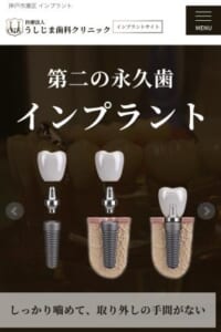 3000症例以上インプラント手術経験ある医師駐在する「医療法人うしじま歯科クリニック」